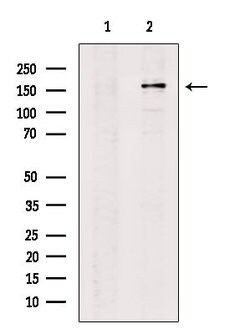 Invitrogen BLM Polyclonal Antibody 100 μL; Unconjugated:Antibodies,