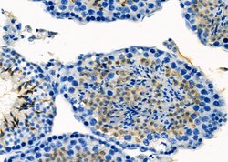 Invitrogen IBSP Polyclonal Antibody 100 &mu;L; Unconjugated:Antibodies,