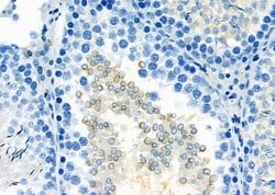 Invitrogen IBSP Polyclonal Antibody 100 &mu;L; Unconjugated:Antibodies,
