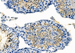 Invitrogen IBSP Polyclonal Antibody 100 &mu;L; Unconjugated:Antibodies,