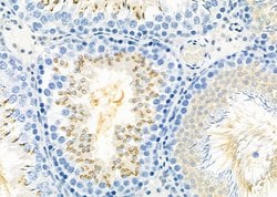 Invitrogen IBSP Polyclonal Antibody 100 &mu;L; Unconjugated:Antibodies,