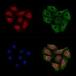 Invitrogen Brachyury Polyclonal Antibody 100 μL; Unconjugated:Antibodies,