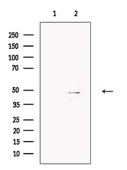 Invitrogen Brachyury Polyclonal Antibody 100 μL; Unconjugated:Antibodies,