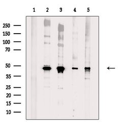 Invitrogen Brachyury Polyclonal Antibody 100 μL; Unconjugated:Antibodies,