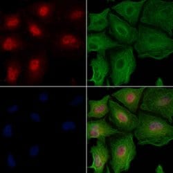 Invitrogen BUB1 Polyclonal Antibody 100 &mu;L; Unconjugated:Antibodies,
