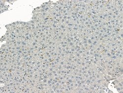 Invitrogen Complement C3 Polyclonal Antibody 100 &mu;L; Unconjugated:Antibodies