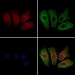 Invitrogen ATAT1 Polyclonal Antibody 100 &mu;L; Unconjugated:Antibodies,