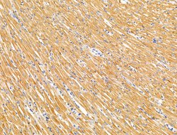 Invitrogen ATAT1 Polyclonal Antibody 100 &mu;L; Unconjugated:Antibodies,