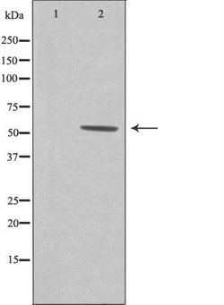 Invitrogen ZNHIT6 Polyclonal Antibody 100 &mu;L; Unconjugated:Antibodies,