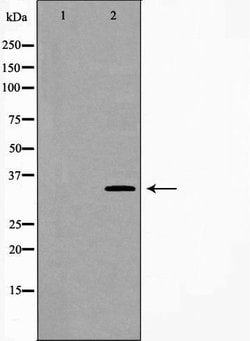 Invitrogen™ Carbonic Anhydrase IV Polyclonal Antibody