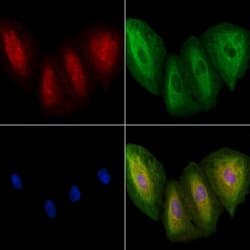 Invitrogen CACNA2D1 Polyclonal Antibody 100 &mu;L; Unconjugated:Antibodies,