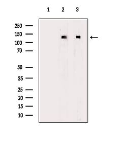 Invitrogen CACNA2D1 Polyclonal Antibody 100 &mu;L; Unconjugated:Antibodies,