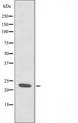 Invitrogen RCAN1 Polyclonal Antibody 100 &mu;L; Unconjugated:Anticuerpos