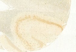 Invitrogen Calnexin Polyclonal Antibody 100 &mu;L; Unconjugated:Antibodies,
