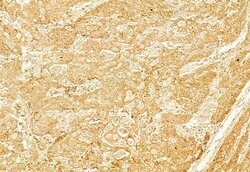 Invitrogen Calnexin Polyclonal Antibody 100 &mu;L; Unconjugated:Antibodies,