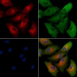 Invitrogen Calreticulin 3 Polyclonal Antibody 100 &mu;L; Unconjugated:Antibodies,