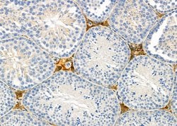 Invitrogen Calreticulin 3 Polyclonal Antibody 100 &mu;L; Unconjugated:Antibodies,