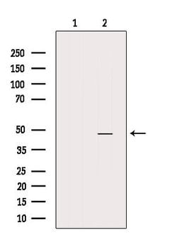 Invitrogen Calreticulin 3 Polyclonal Antibody 100 &mu;L; Unconjugated:Antibodies,