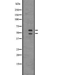 Invitrogen CaMKII alpha Polyclonal Antibody 100 &mu;L; Unconjugated:Antibodies,
