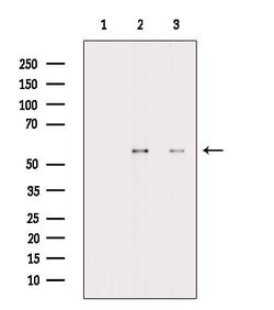 Invitrogen CaMKII delta Polyclonal Antibody 100 &mu;L | Buy Online | Invitrogen&trade; | Fisher Scientific