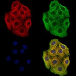 Invitrogen CAP1 Polyclonal Antibody 100 &mu;L; Unconjugated:Antibodies,