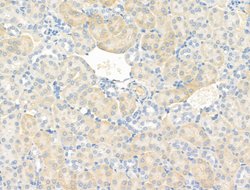 Invitrogen CAP1 Polyclonal Antibody 100 &mu;L; Unconjugated:Antibodies,