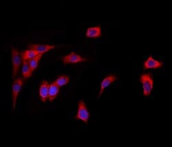 GPIP137 Polyclonal Antibody:Antibodies, Polyclonal