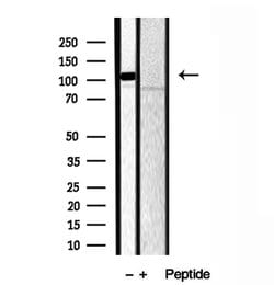 GPIP137 Polyclonal Antibody:Antibodies, Polyclonal