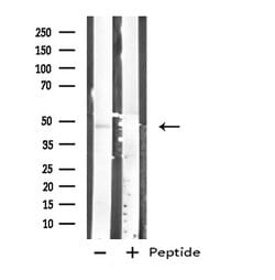 Invitrogen Carboxypeptidase A1 Polyclonal Antibody 100 &mu;L; Unconjugated:Antibodies,