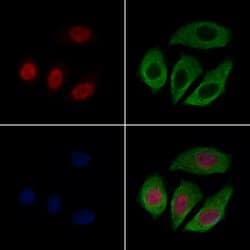 Invitrogen CASC5 Polyclonal Antibody 100 &mu;L; Unconjugated:Antibodies,