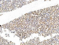Invitrogen CASC5 Polyclonal Antibody 100 &mu;L; Unconjugated:Antibodies,
