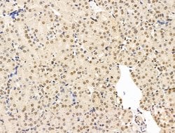 Invitrogen CASC5 Polyclonal Antibody 100 &mu;L; Unconjugated:Antibodies,
