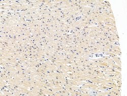 Invitrogen CASC5 Polyclonal Antibody 100 &mu;L; Unconjugated:Antibodies,
