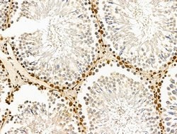 Invitrogen CASC5 Polyclonal Antibody 100 &mu;L; Unconjugated:Antibodies,