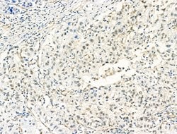 Invitrogen HP1 beta Polyclonal Antibody 100 &mu;L; Unconjugated:Antibodies,