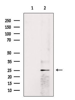 Invitrogen HP1 beta Polyclonal Antibody 100 &mu;L; Unconjugated:Antibodies,