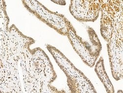 Invitrogen CCDC28A Polyclonal Antibody 100 &mu;L | Buy Online | Invitrogen&trade; | Fisher Scientific