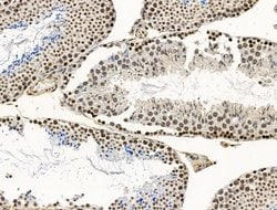 Invitrogen CCDC28A Polyclonal Antibody 100 &mu;L | Buy Online | Invitrogen&trade; | Fisher Scientific