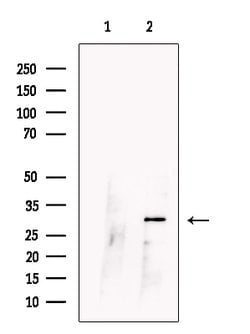 Invitrogen CCDC28A Polyclonal Antibody 100 &mu;L | Buy Online | Invitrogen&trade; | Fisher Scientific