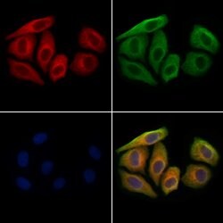 Invitrogen CCL14 Polyclonal Antibody 100 &mu;L; Unconjugated:Antibodies,