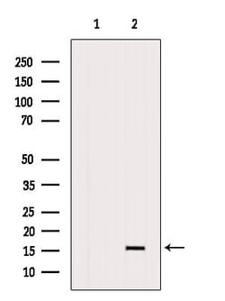 Invitrogen CCL21 Polyclonal Antibody 100 &mu;L | Buy Online | Invitrogen&trade; | Fisher Scientific