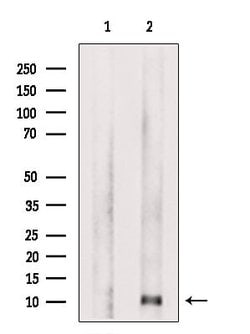 Invitrogen CCL4 Polyclonal Antibody 100 &mu;L | Buy Online | Invitrogen&trade; | Fisher Scientific