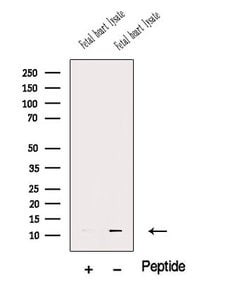 Invitrogen MCP-2 Polyclonal Antibody 100 &mu;L; Unconjugated:Antibodies,