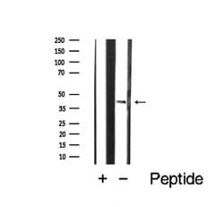 Invitrogen CCR5 Polyclonal Antibody 100 μL; Unconjugated:Antibodies,