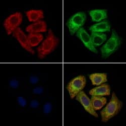 Invitrogen CCR8 Polyclonal Antibody 100 &mu;L; Unconjugated:Antibodies,
