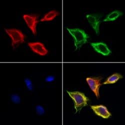 Invitrogen CD166 Polyclonal Antibody 100 &mu;L; Unconjugated:Antibodies,