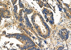 Invitrogen CD166 Polyclonal Antibody 100 &mu;L; Unconjugated:Antibodies,