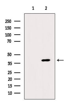 Invitrogen CD1a Polyclonal Antibody 100 &mu;L; Unconjugated:Antibodies,