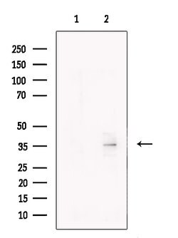 Invitrogen CD1a Polyclonal Antibody 100 &mu;L; Unconjugated:Antibodies,