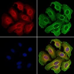 Invitrogen CD20 Polyclonal Antibody 100 &mu;L; Unconjugated:Antikörper